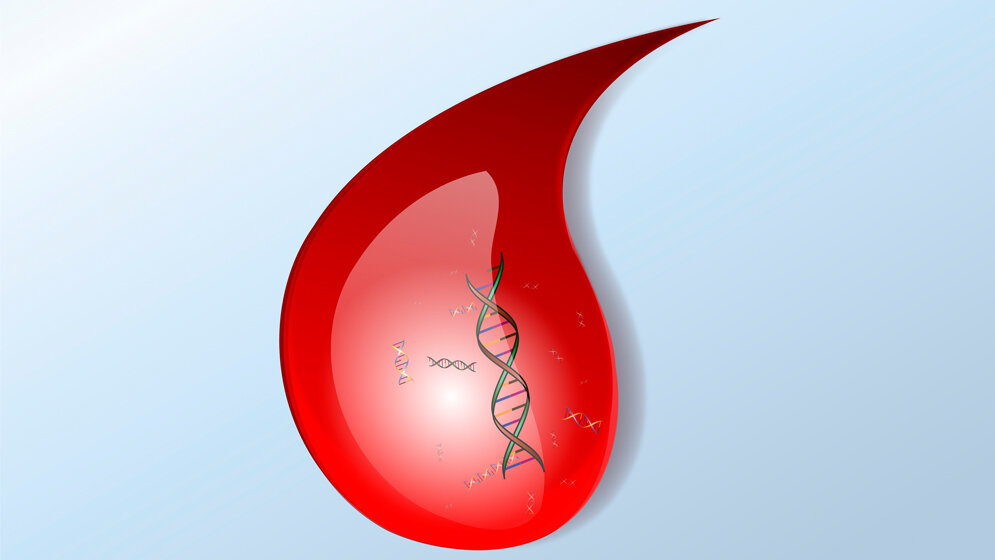 Liquid Biopsy