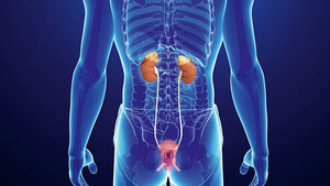 Gefäßdarstellung beim niereninsuffizienten Patienten