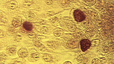 200fache_Vergroesserung_McCoy_Zellkultur_die_mit_Chlamydia_trachomatis_Bakterien_beimpft_wurde_CDC_Dr_E_Arum_Dr_N_Jacobs_public_domain.jpg Chlamydia trachomatis