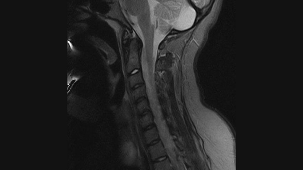 Schnittbilddiagnostik der Wirbelsäule (7.19)
