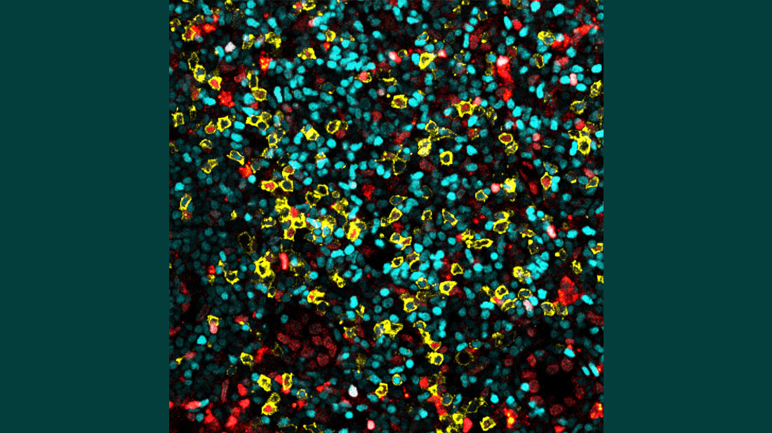 Eine Aufnahme von Immunzellen in einem Lymphknoten.