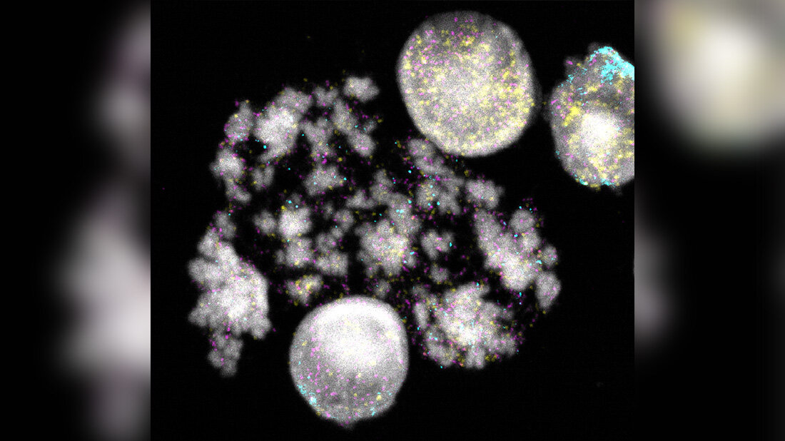 DNA_Ringe_krebszellen.jpg Wie DNA-Ringe entstehen und wie sie sich auf das Tumorwachstums auswirken