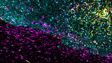 Mikroskopische Aufnahme von Gewebequerschnitten eines Mausgehirns mit Glioblastom.