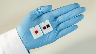 CE-Zeichen für VITROS® XT MicroSlide