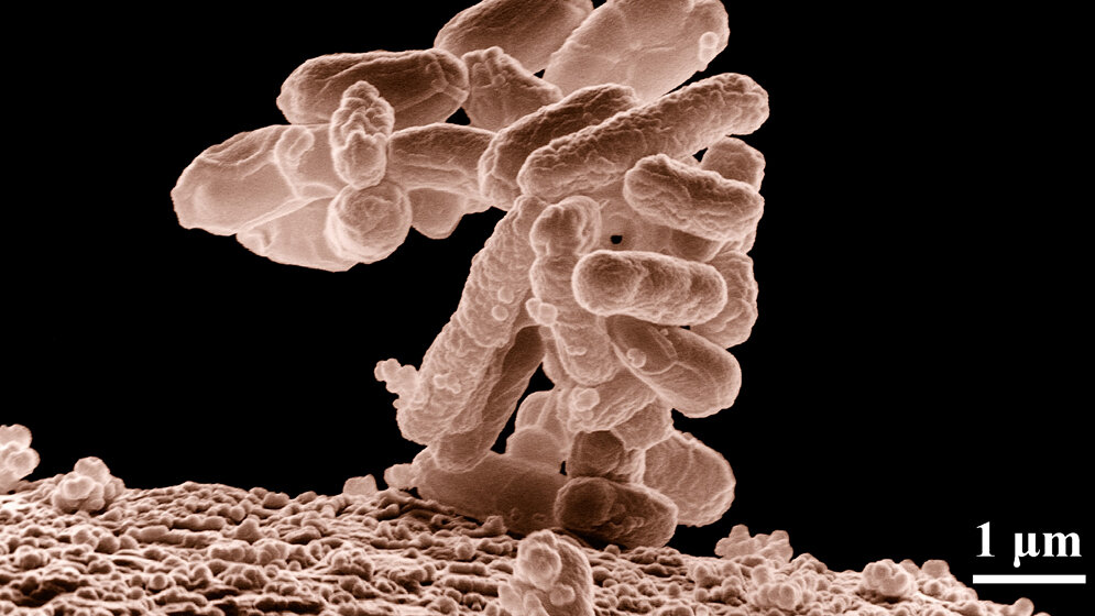E. coli Bakterien.