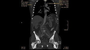 Schnittbilddiagnostik der Wirbelsäule (4.19)