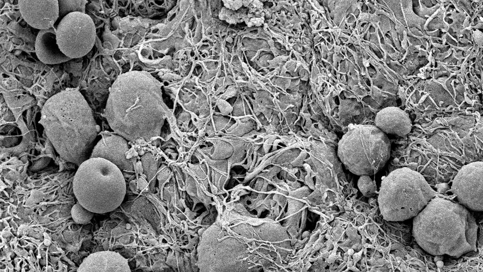 Rasterelektronenmikroskopische_Aufnahme_der_geschaedigten_Ependymschicht_Anja_Feldner_Manfred_Ruppel_DKFZ.jpg REM geschädigte Ependymschicht