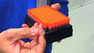 Biobanking Laboratoriumsmedizin
