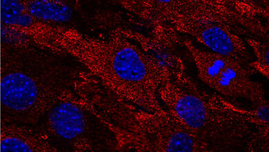Zellen einer Maus mit menschlichem MxA-Protein 