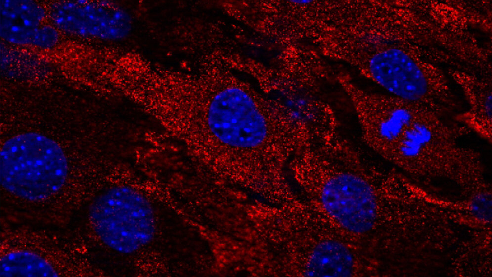 Zellen_einer_Maus_mit_menschlichem_MxA_Protein_MxA_rot_Zellkerne_blau_Deeg_et_al_2017.jpg Zellen einer Maus mit menschlichem MxA-Protein