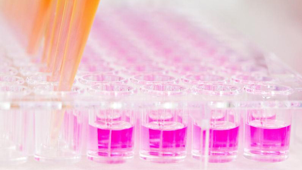 universitaetsklinikum-Heidelberg.jpg Entwicklungsstörungen bei Kleinkindern