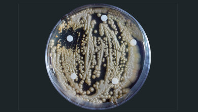 Petrischale vor schwarzem Hintergrund mit Ausstrichen eines Pilzes