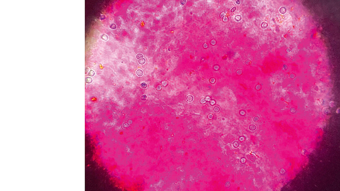 Mikroskopische Aufnahme von Kryptosporidien