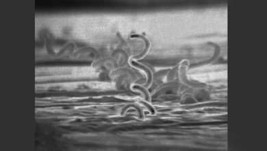 Treponema pallidum