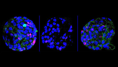Colon_Organoide.jpg Humane Colon-Organoide (blau) mit drei Treg-Zellkulturen
