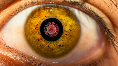 neurologische Folgen