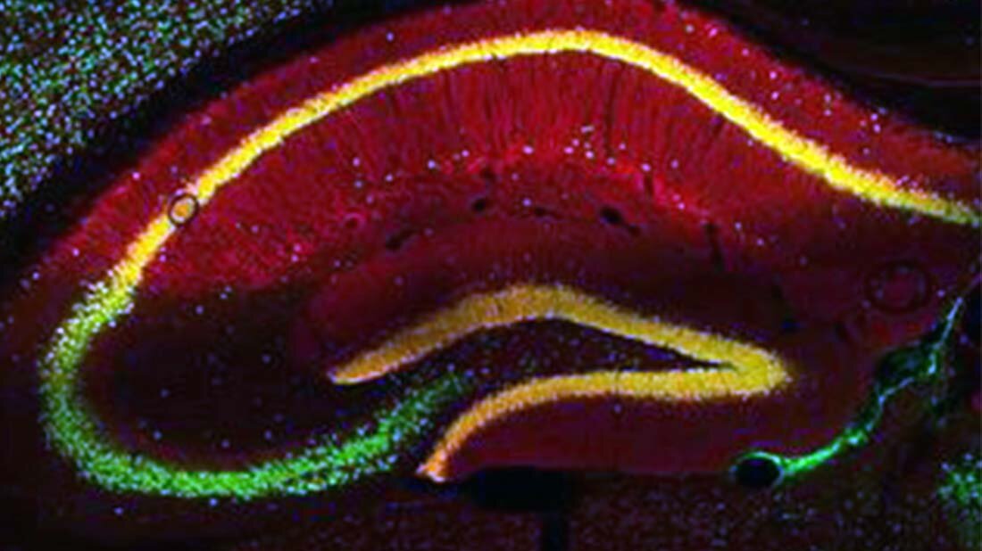 Signalweg im Gehirn zur Steuerung der Nahrungsaufnahme entschlüsselt