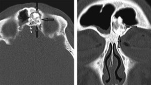 Anomalien und Normvarianten