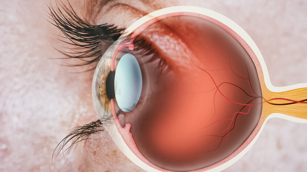 Auge_Adobe.jpg Biomarker für MS