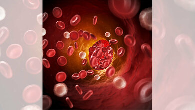 Blutgerinnung und Lungenkrebs