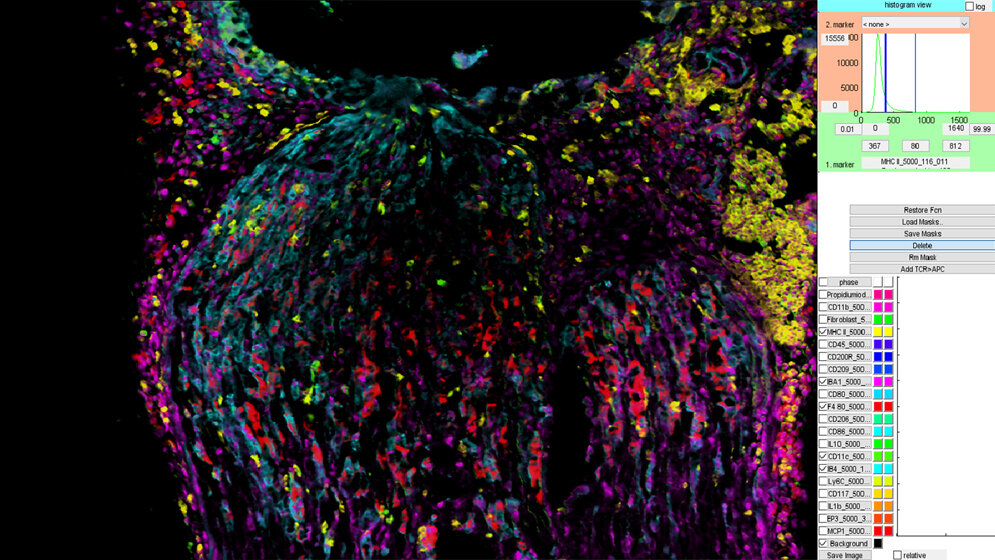 Fluoreszenzaufnahme von verschiedenen Immunzellen