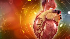 Heart CT Scan