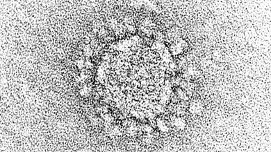COVID-19-Infektionen bei HIV-infizierten Patienten