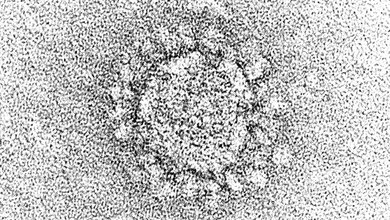 Sonstiges COVID-19-Infektionen bei HIV-infizierten Patienten