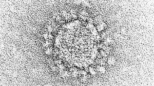 COVID-19-Infektionen bei HIV-infizierten Patienten