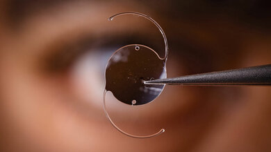 Anomalien und Normvarianten – Kranielle Veränderungen 1.10: Artefizielle Augenlinsen Großaufnahme einer künstlichen Augenlinse