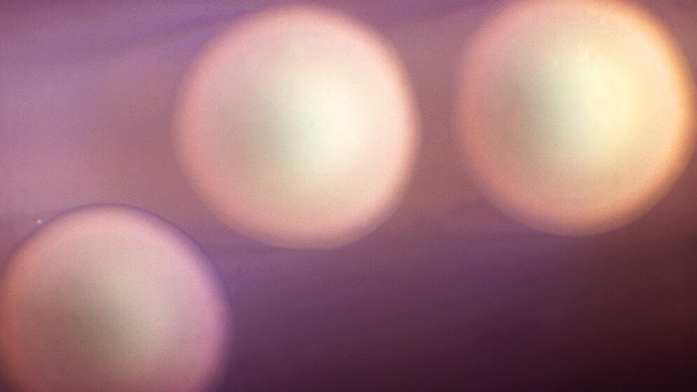 137 epidemische Ausbrüche Meningitis