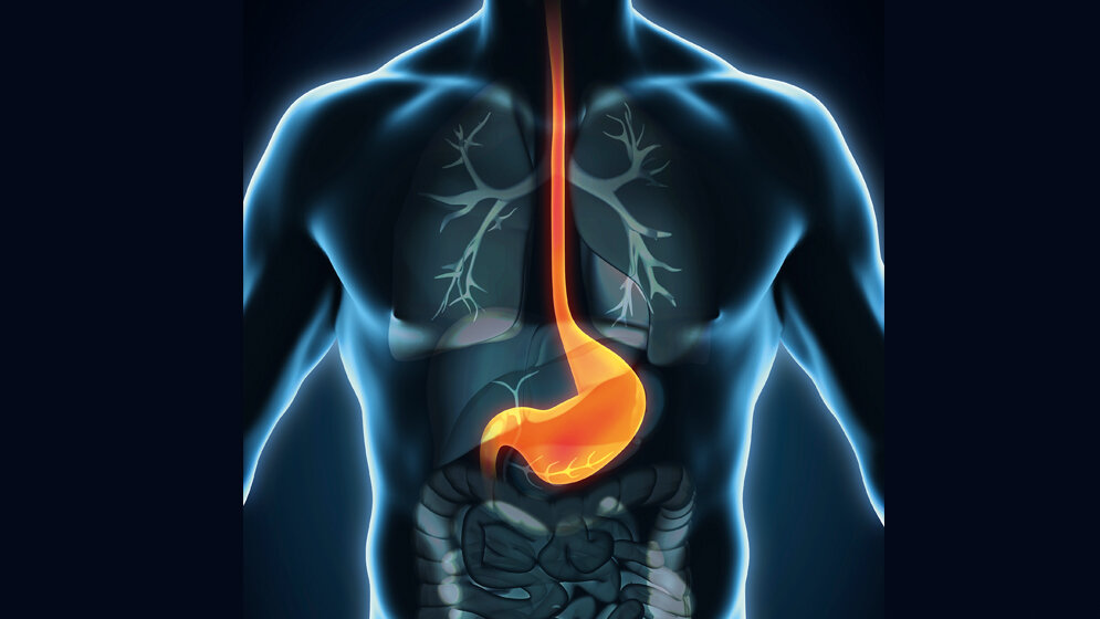 Magen_nerthuz_Fotolia.jpg Magen_nerthuz_Fotolia.jpg