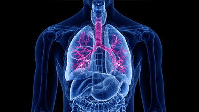 COPD