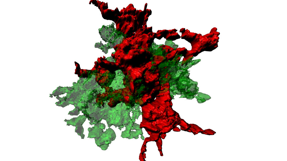 Fresszellen des Gehirns (Mikroglia) 