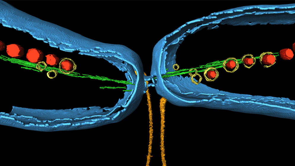 Magnetospirillum gryphiswaldense