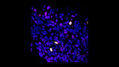 Produktion des Proteins BCOR 