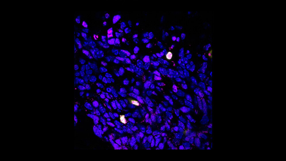 Produktion des Proteins BCOR 