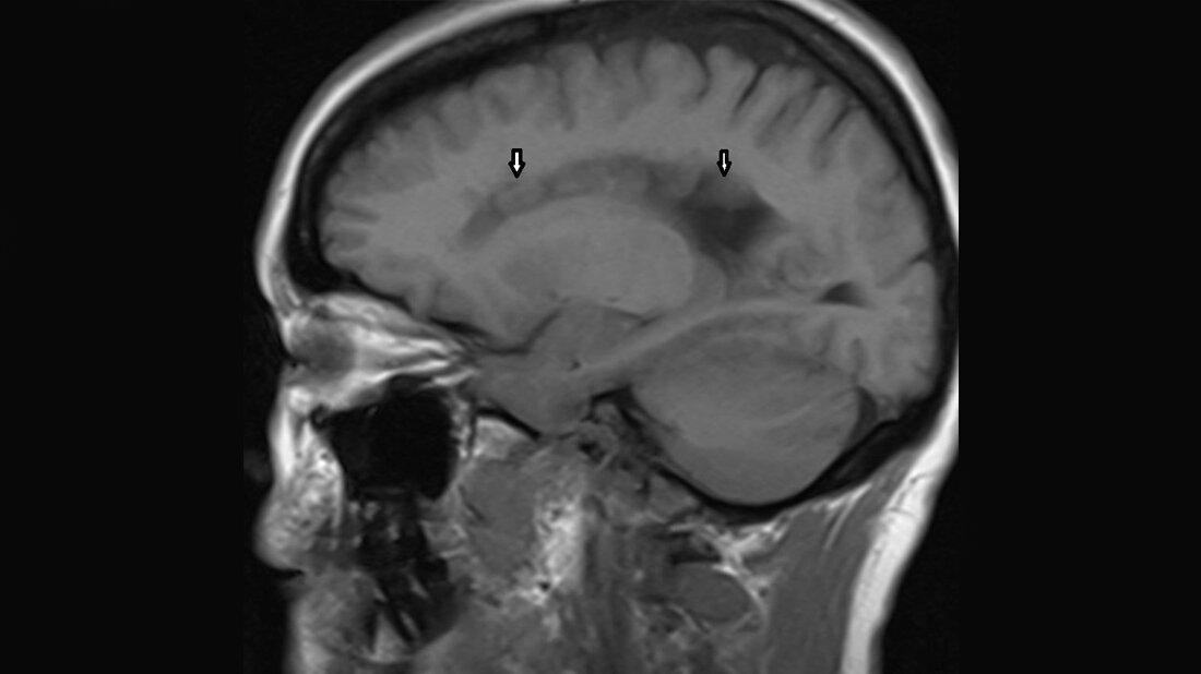 Titelbild zum Faschbeitrag zur Bildgebung bei Heterotopie