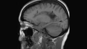 Titelbild zum Faschbeitrag zur Bildgebung bei Heterotopie