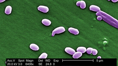 Bacillus anthracis 