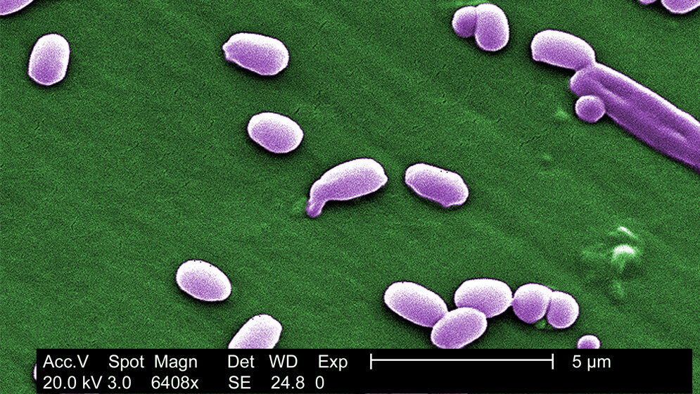 Bacillus anthracis 