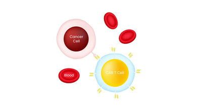 Funktionsweise der CAR-T-Zelltherapie