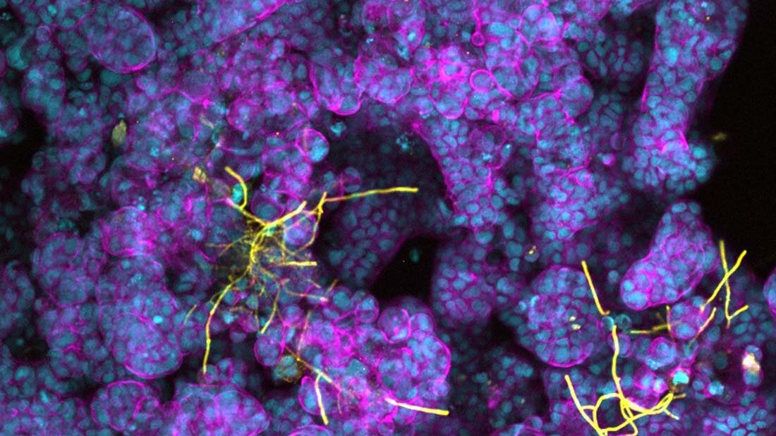 Hefepilz_im_Darm.jpg Probiotika können eine Verbreitung von Pilzinfektionen im Darm eindämmen oder verhindern.