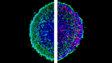 Mikroskopische Aufnahmen von im Labor gezüchteten Mini-Netzhäuten