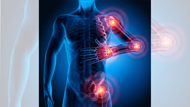 Symbolbild für Rheuma-Schmerzpunkte.