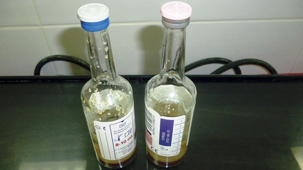 Abnahme von Blutkulturen bei Sepsisverdacht