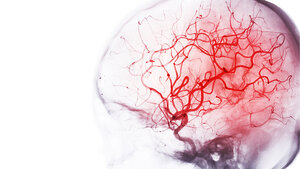 Darstellung der Hirngefäße