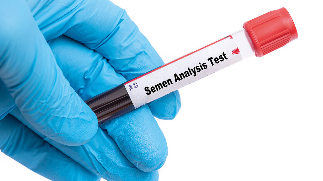 Semen Analysis (Spermiogram) Titelbild des englischen Beitrags über Samenanalyse