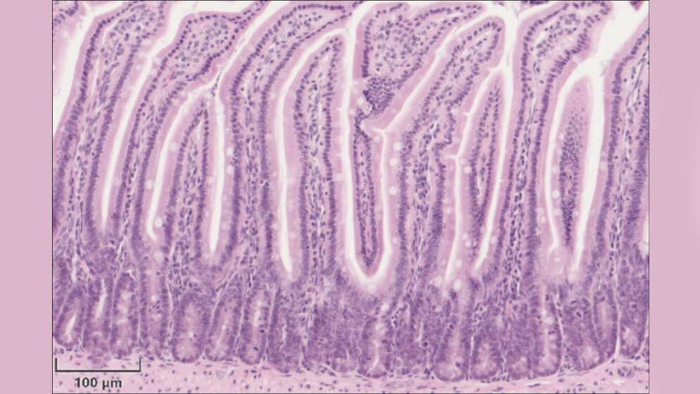Hämatoxylin-Eosin-Färbung