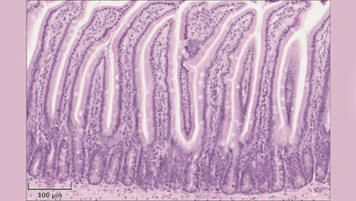 Hämatoxylin-Eosin-Färbung